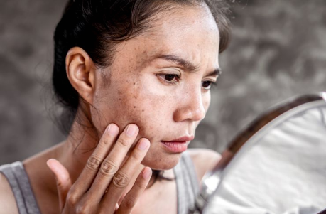 Melanotan II Before and After Complete Guide: Common Questions, Risks, and Better Comparison Criteria